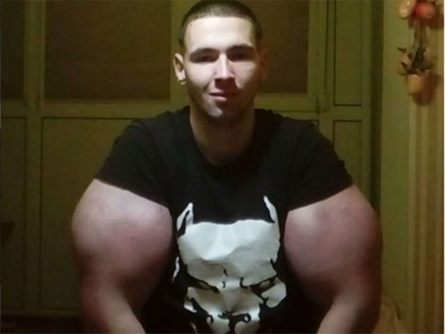 751