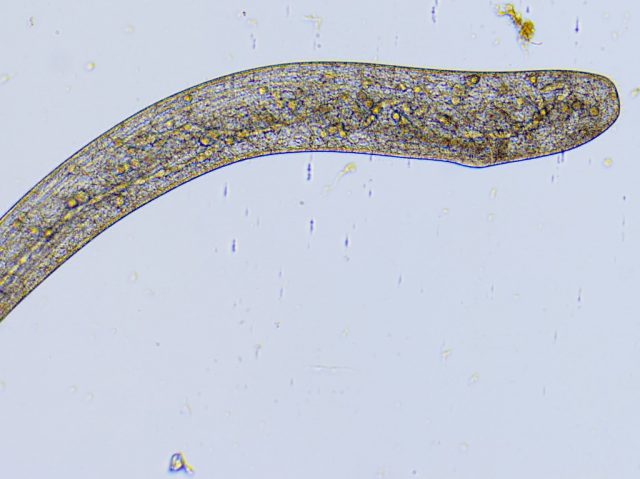 Spirostomum_macronucleus