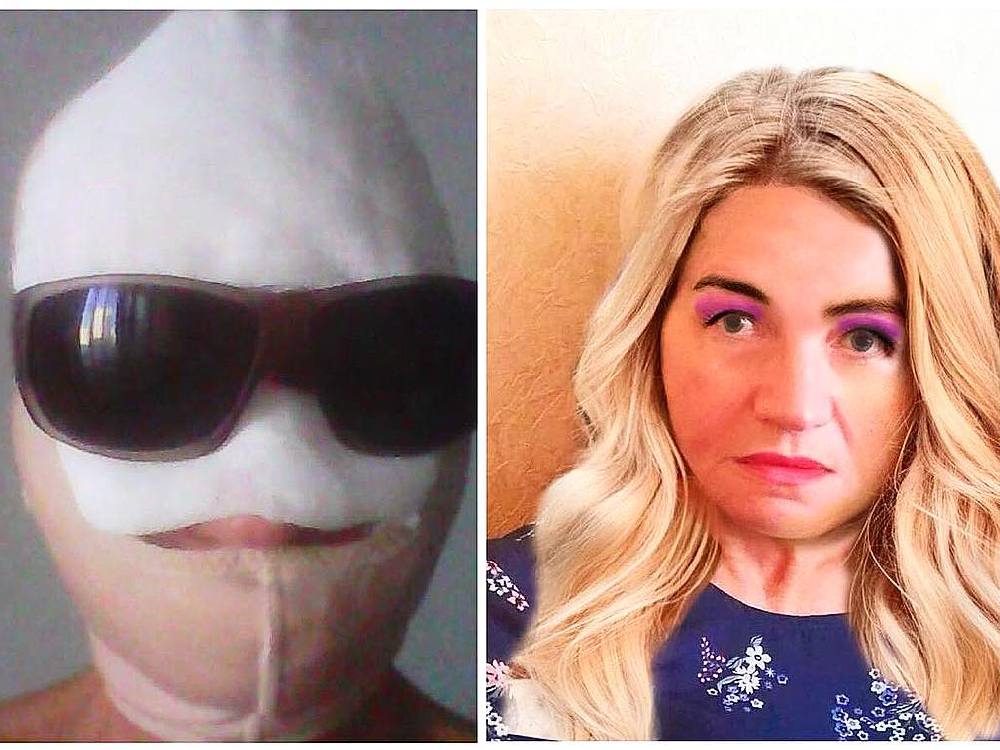 Жена гогена до и после операции фото