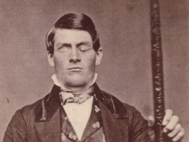 m04. phineasgage1-bca69df0b020421eb41a8e748ab172bd
