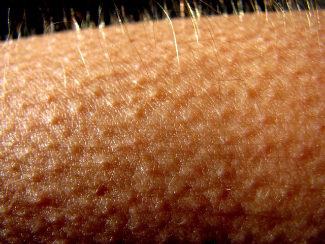 551