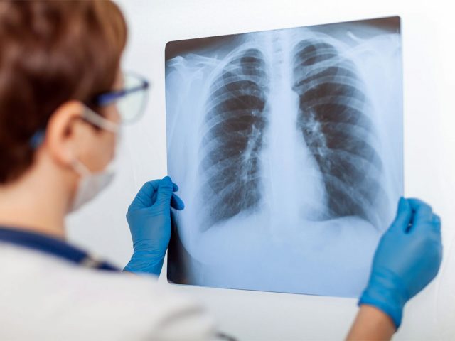 lungs